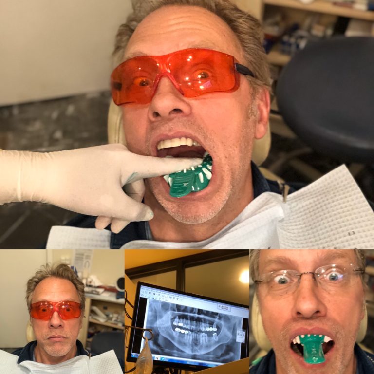 Montage of images of Reid —late-40s white, cis man, wearing red Bono type, huge sunglasses, with blonde hair— at the dentist